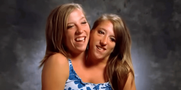 Conjoined Twin Abby Hensel Quietly Married In 2021